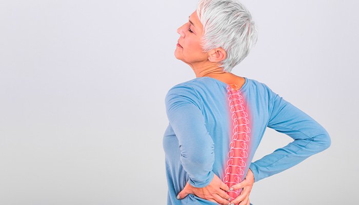 Espondilite Anquilosante